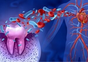 The Link Between Oral Hygiene And Chronic Health Conditions