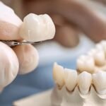 From Cleanings To Crowns: Blending Function And Beauty In Dentistry