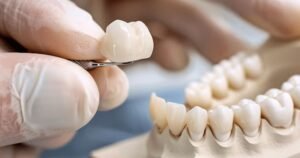 From Cleanings To Crowns: Blending Function And Beauty In Dentistry