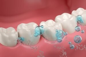 The Truth About Fluoride And Its Role In Dental Care