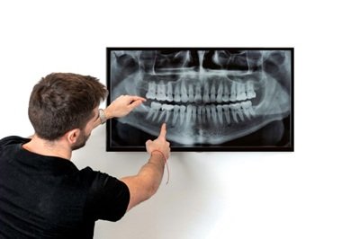 Understanding The Use Of X Rays In General Dentistry