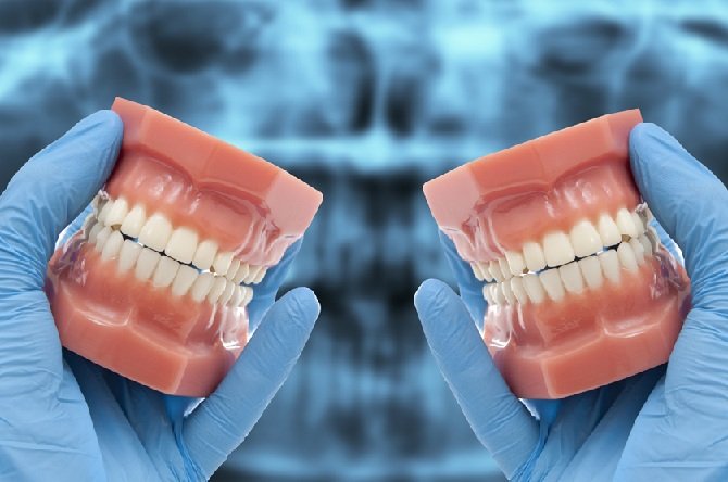 Understanding The Mechanics Of Your Bite Through General Dentistry
