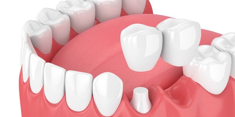 Bridging Preventive Care With Aesthetic Enhancements In One Dental Plan