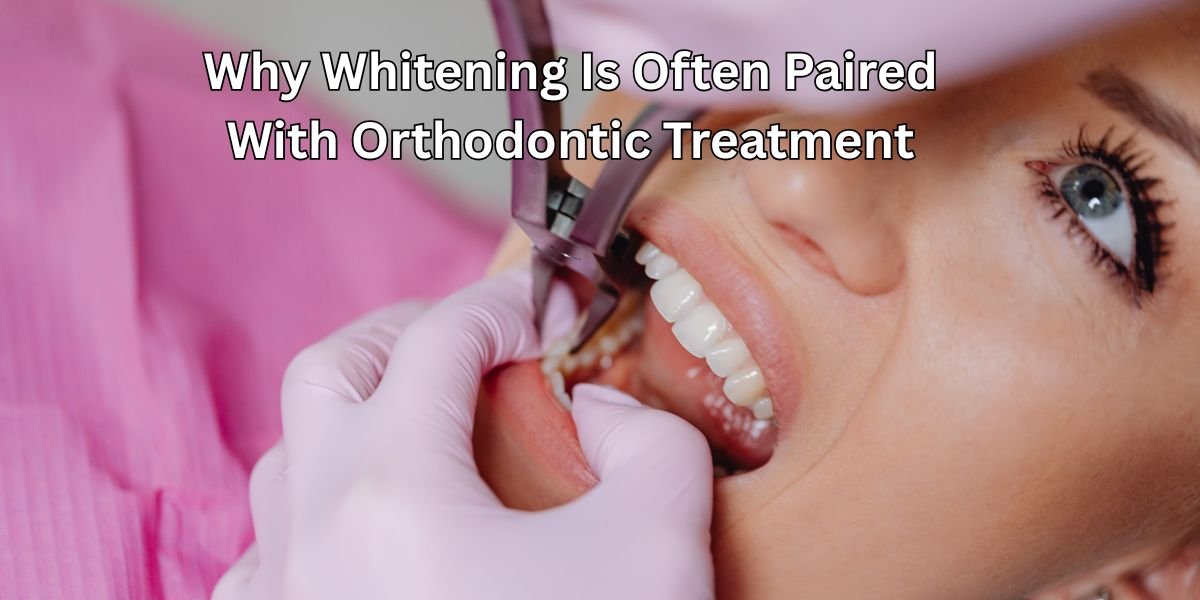 Why Whitening Is Often Paired With Orthodontic Treatment